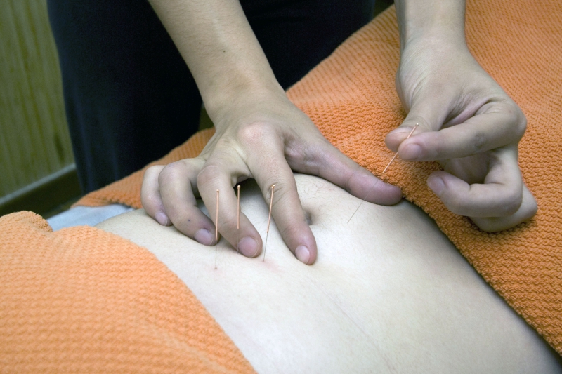 osteopathe-PEILLE-min_acupuncture-4175625